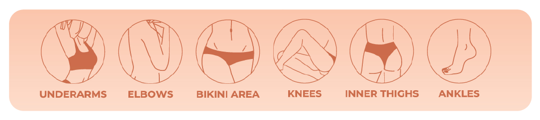 Underarms, elbows, bikini area, knees, inner thighs and ankles